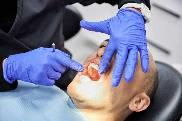 Best Knocked-Out Tooth (Avulsed Tooth) Treatment in Drum Point, MD